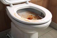 久野智能马桶服务网络枢纽剖析-华艺智能马桶发热故障解决指南